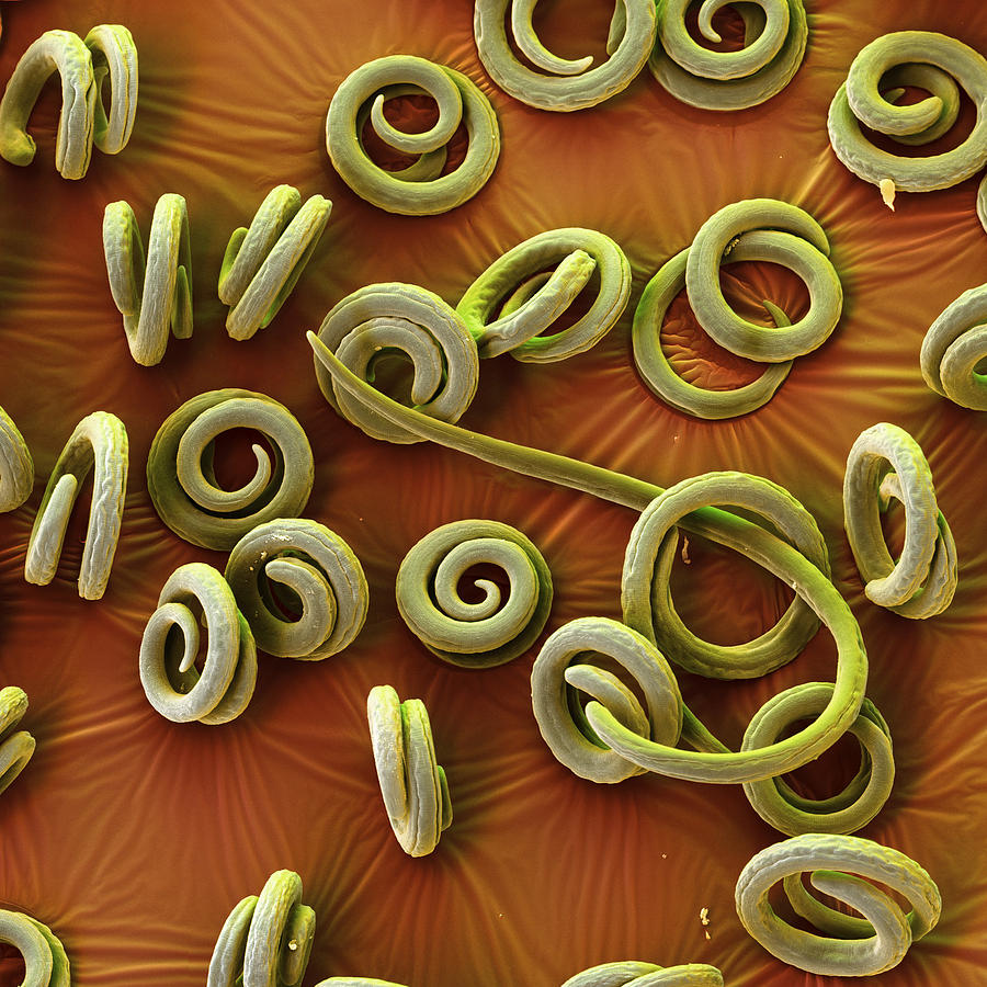 Trichinella spiralis